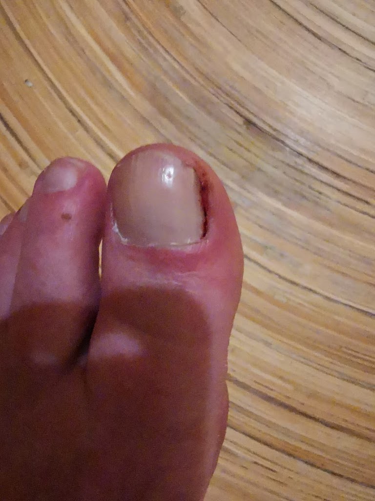 klinik-for-fodterapi-v-malene-lang-fodbehandling-bojlebehandling-indlaeg-0.jpeg
