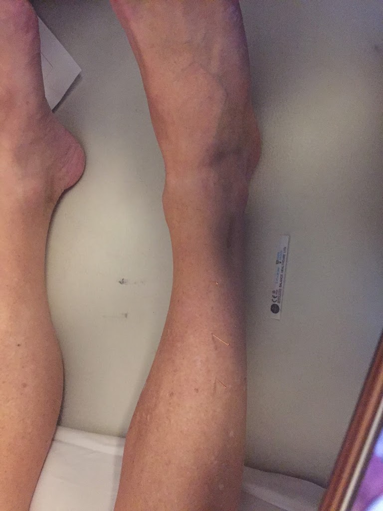 gribskov-acupuncture-clinic-7.jpeg