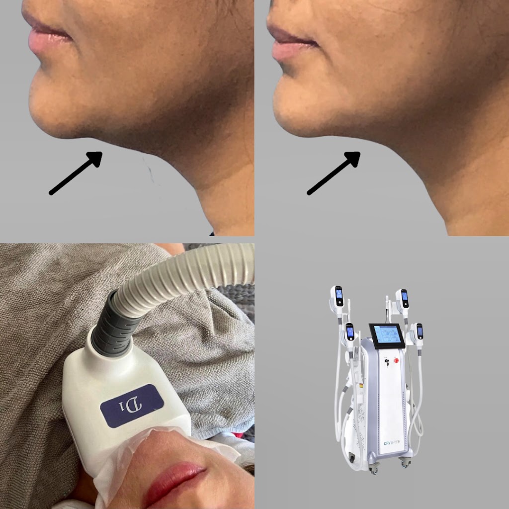new-laser-clinic-fjernelse-af-tatoveringer-emsculpting-14.jpeg