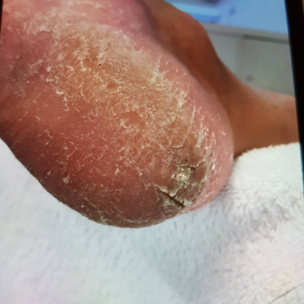 lynge-bytorv-fodklinik-klinik-for-fodterapi-3.jpeg