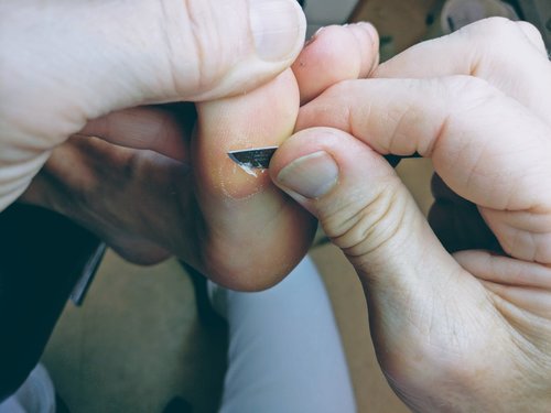 Talende Fod - Klinik for fodterapi